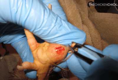 BUMBLEFOOT in Chickens: Causes & treatment. **WARNING: Graphic Photos** Bumblefoot infection removed from chicken's foot pad