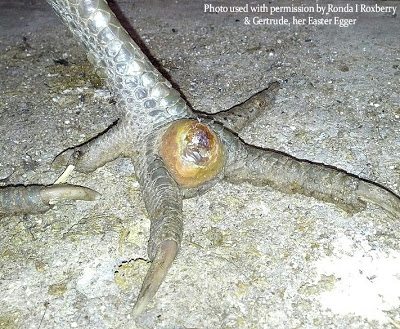 BUMBLEFOOT in Chickens: Causes & treatment. **WARNING: Graphic Photos** Severe case of bumblefoot, which appears at the top of the foot in between toes in this case